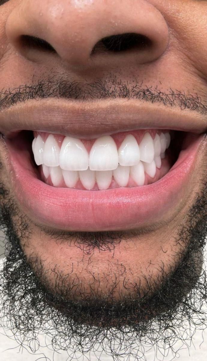 Dents Blanches 🦷 en 7 Jours ? C’est Possible avec Cette  Poudre dentaires !