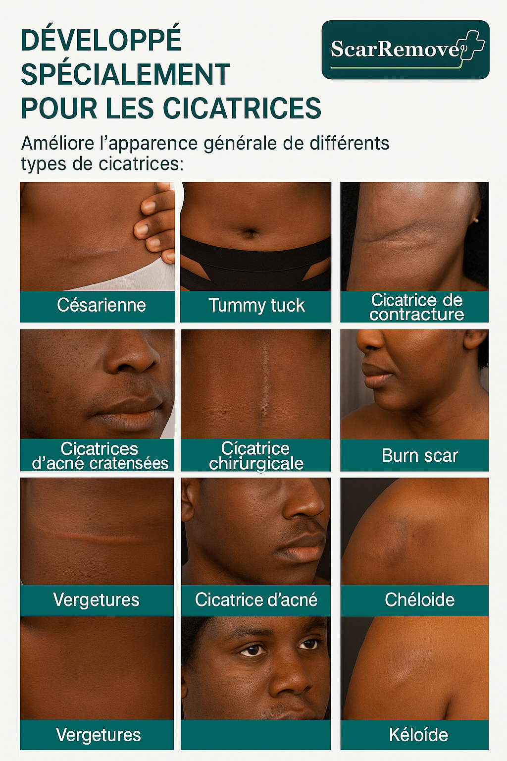 Spray anti-cicatrices pour tous types de cicatrices - cicatrices d'acné, cicatrices chirurgicales et vergetures ⚡️⚡️