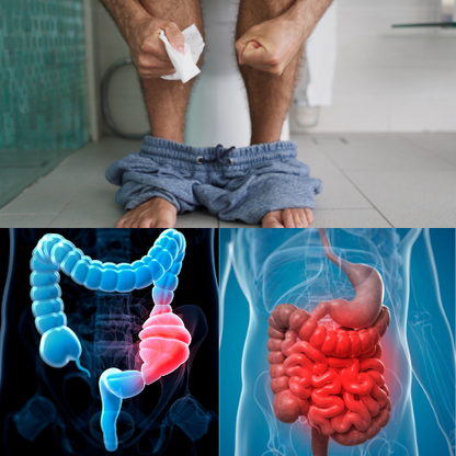 Constipation Terminer en 3 ou 7 jours avec : Le Thé Défécation Qui Vous Libère en Douceur