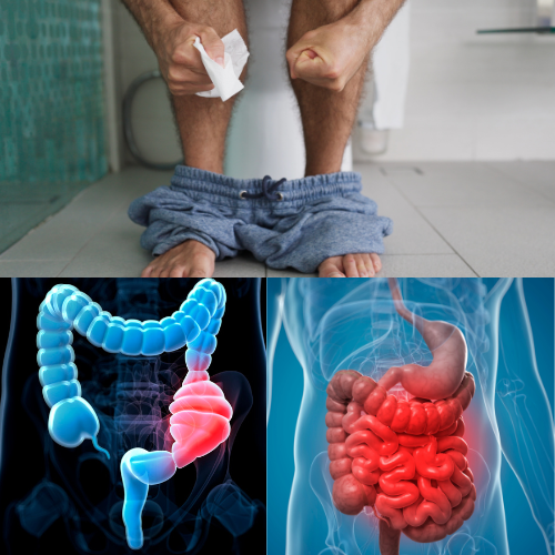 Constipation Terminer en 3 ou 7 jours avec : Le Thé Défécation Qui Vous Libère en Douceur
